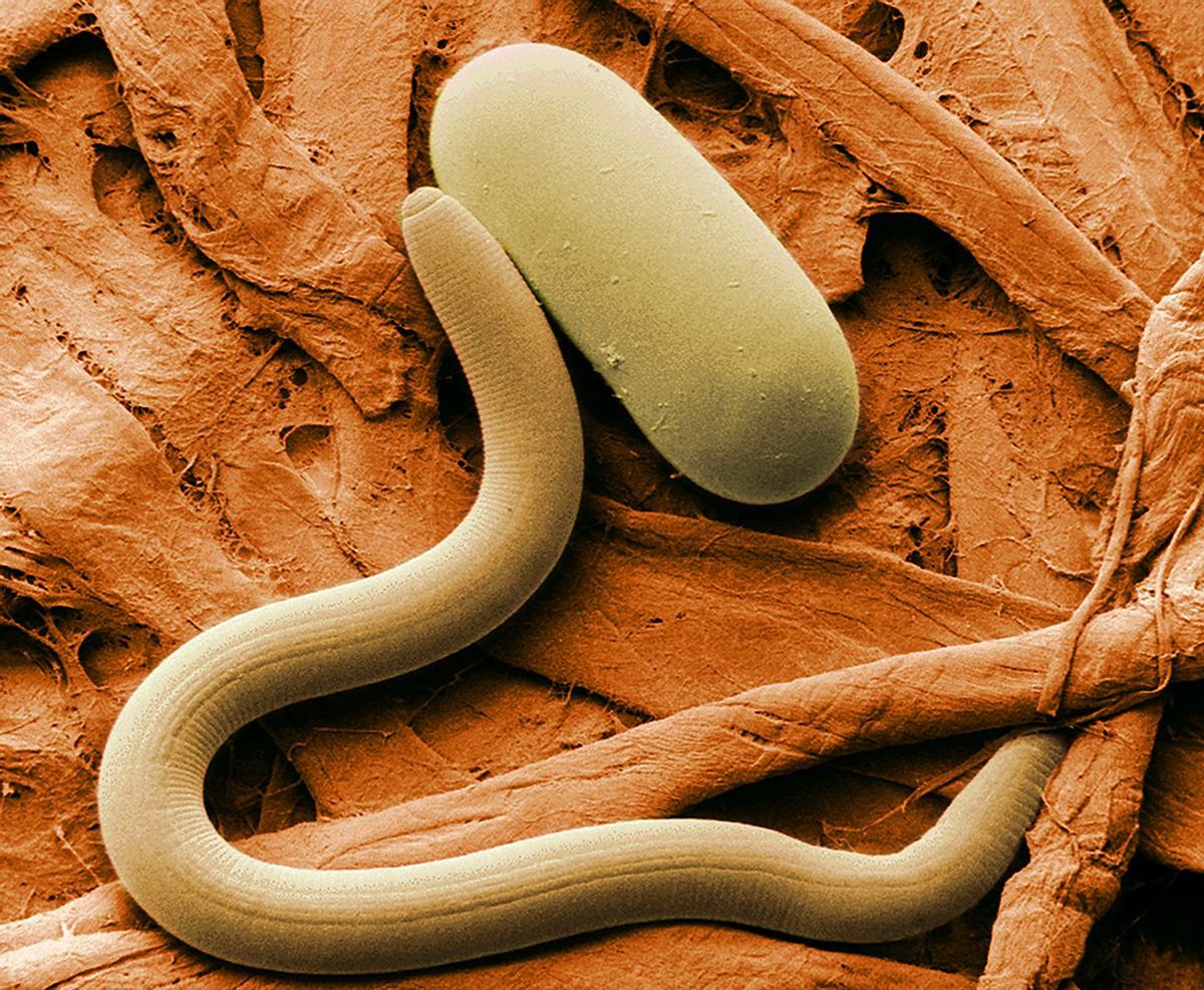 Microfotografía coloreada de un nématodo (Heterodera glycines), Parásito de la planta de soja.
