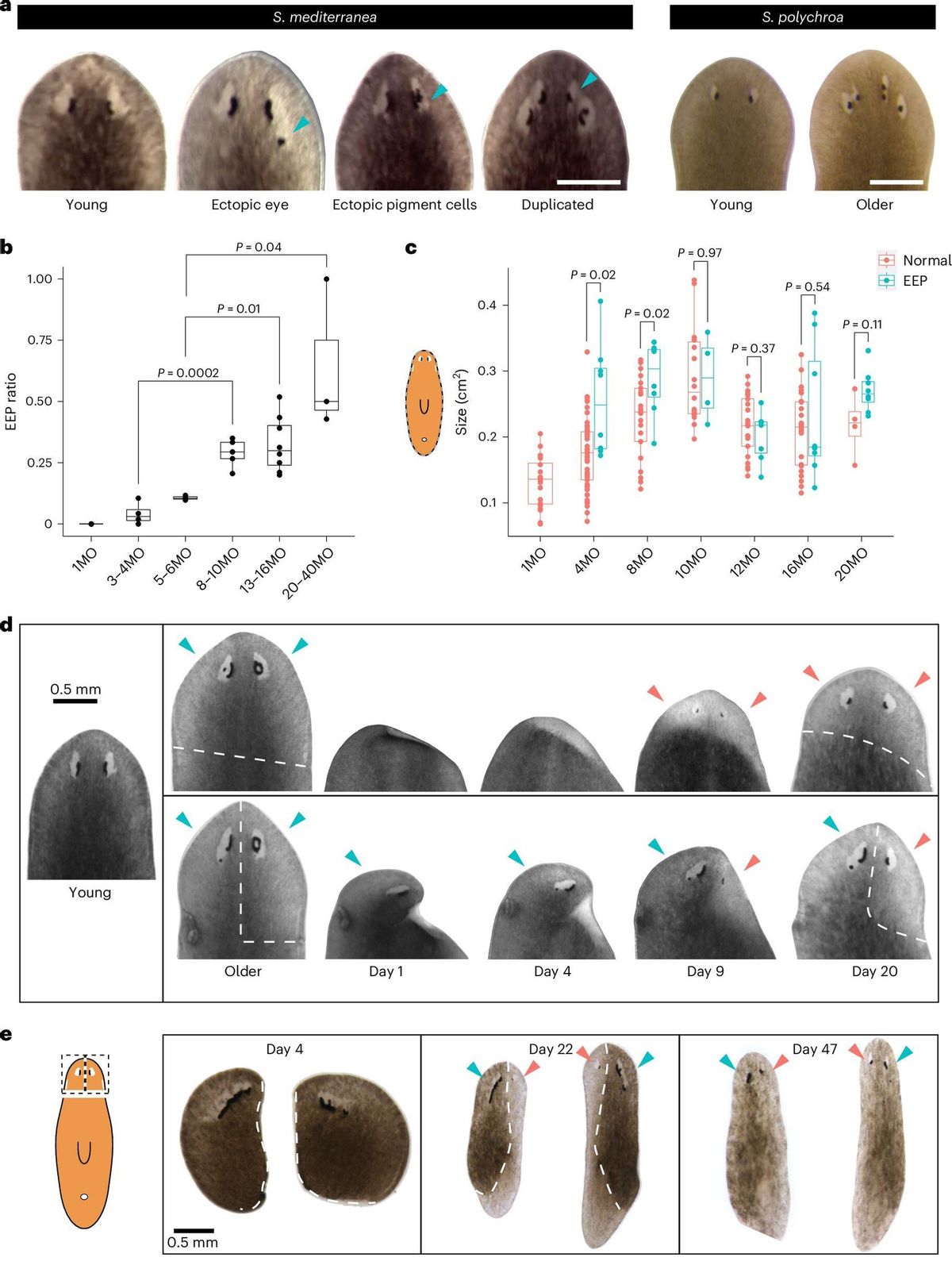 Envejecimiento y Rejuvencimiento de los ojos de planarias.