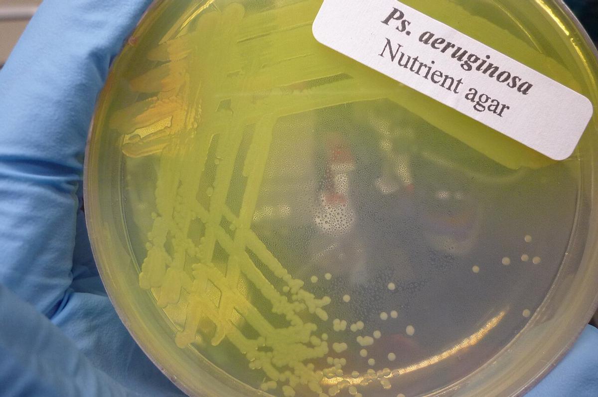 Cultivateur de Pseudomonas aeruginosa.