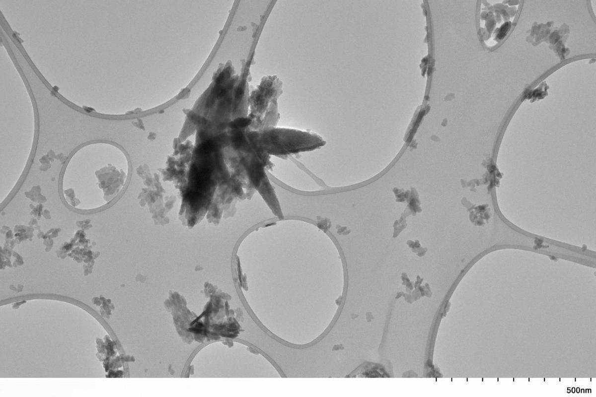 Nanoplastiques adhérant aux artères carotides