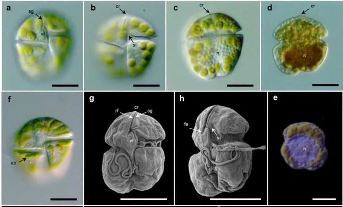 La 'Karenia cristata', en images au microscope