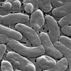 Des cas de bactéries carnivores suscitent des avertissements sanitaires pour la côte du Golfe